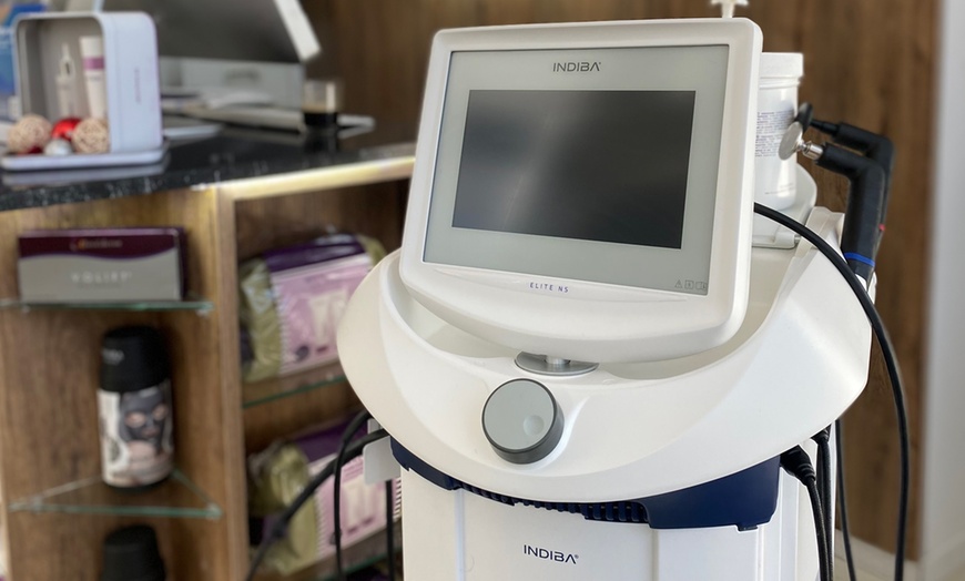 Image 6: Mesoterapia facial para hidratación profunda en 1, 2 o 3 zonas