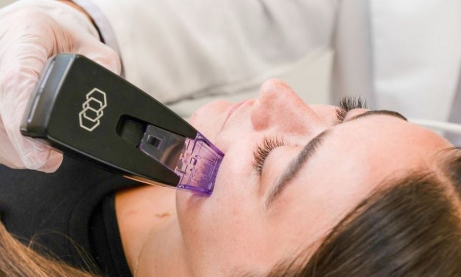 One or Two Morpheus 8 For Full-Face & Neck, Abdomen or Butt