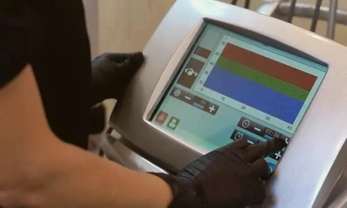 3 or 5 Sessions of Venus Legacy Luxury Radio Frequency Skin Tightening