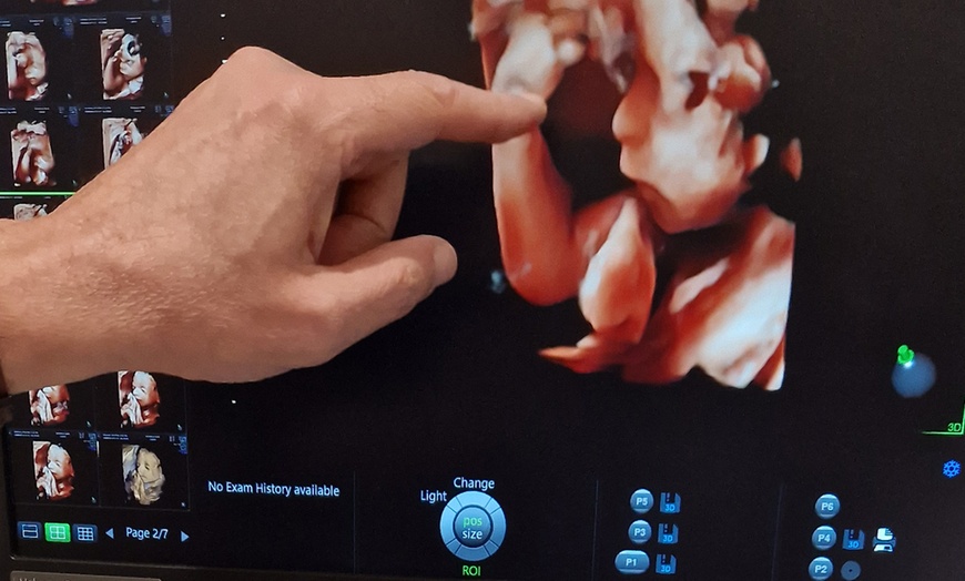 Image 7: Discover Magic: Experience Baby's First Moments in 3D/4D Ultrasound