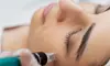 Radiant Skin Awaits with One, Two, or Three Microneedling Sessions at Derm One Beauty (Up To 60% Off)