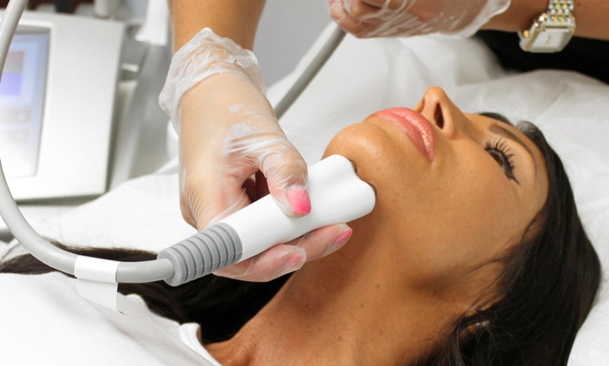 Image 4: One or Three Venus Legacy RF Skin Tightening Treatments