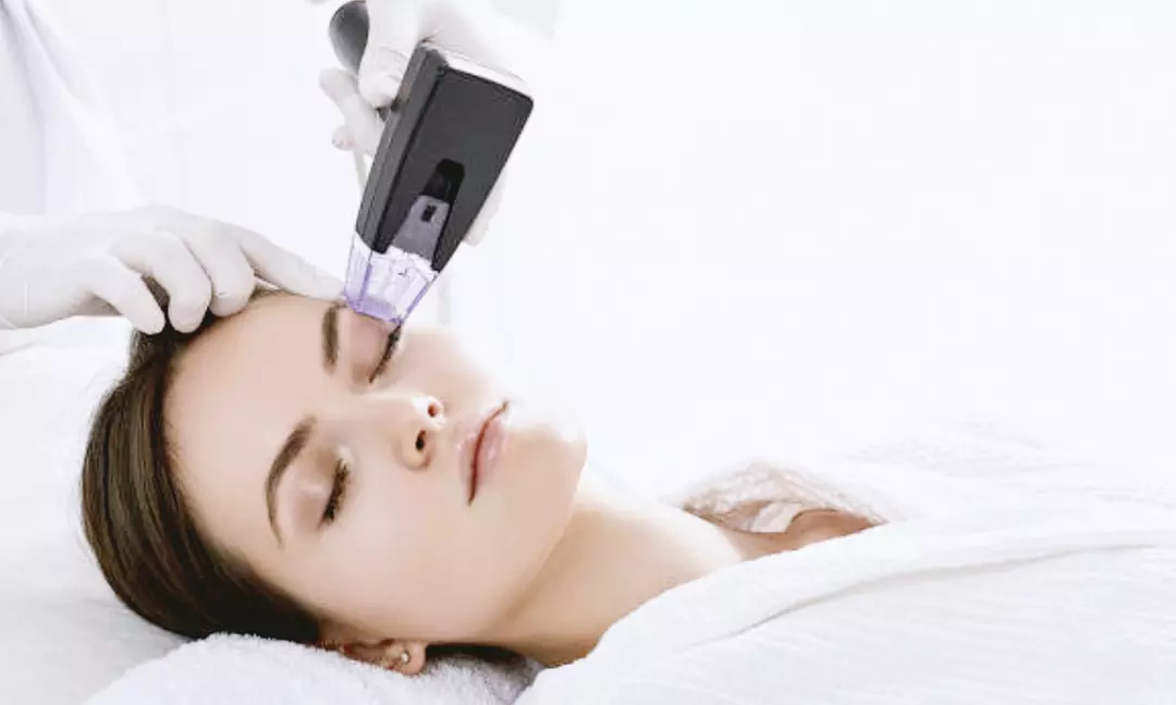 Enhance Your Appearance with One Morpheus8 Treatment at Giffen Aesthetics (Up to 50% Off) - Primary Image