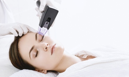 One Morpheus8 Treatment - Giffen Health