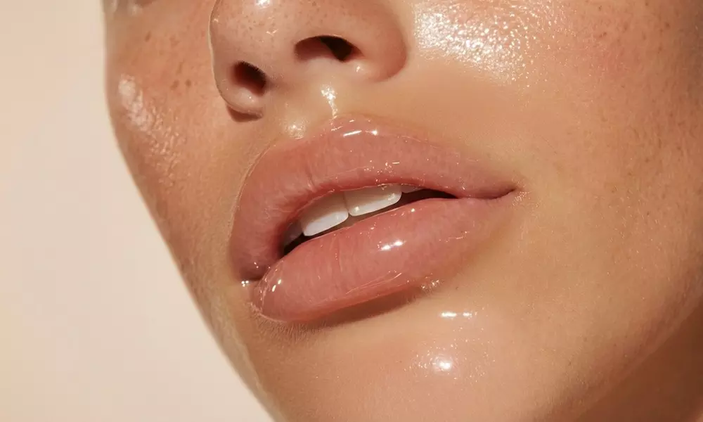 Get the Perfect Pout with One or Two Syringes of RHA Lip Filler at Elora Aesthetics ( Up to 51% Off )