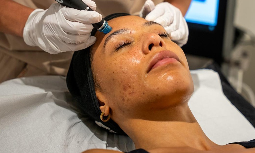 Image 2: Choice of Single or Three Sessions of Facial Packages