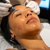 Image 2: Choice of Single or Three Sessions of Facial Packages