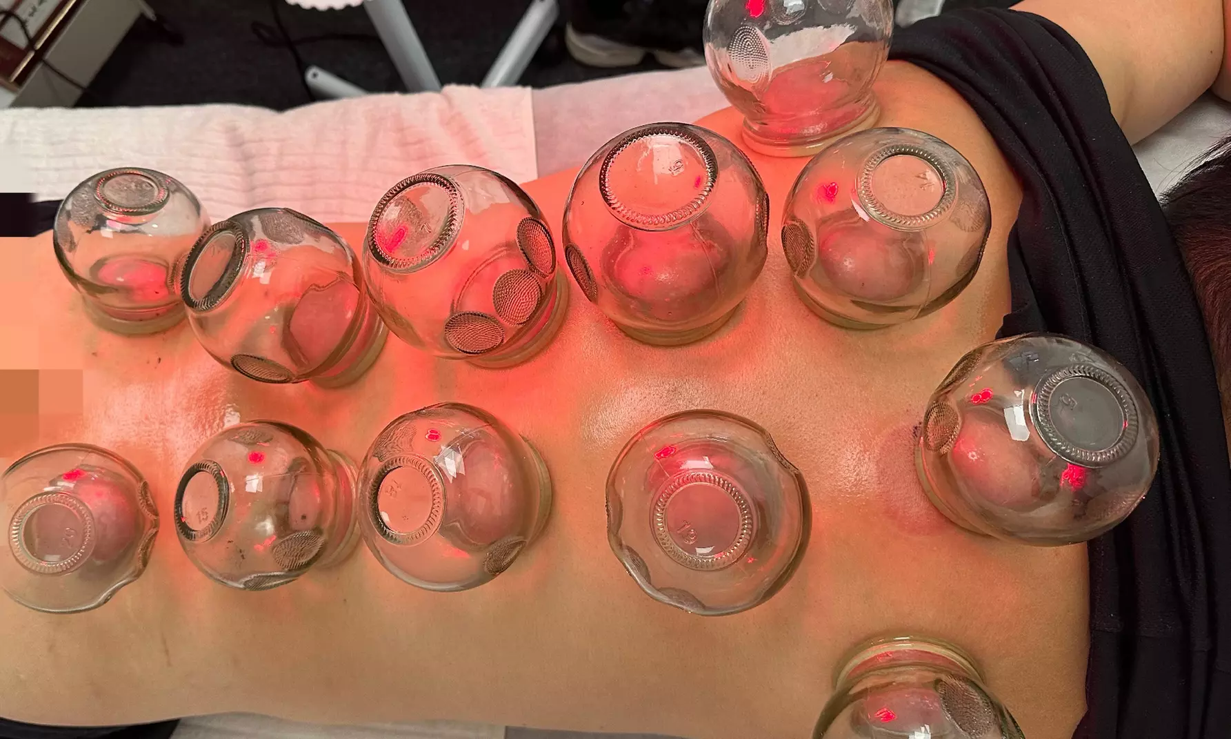 Relax at Long Island Wellness Acupuncture: Consultation w Acupuncture and a Optional Acupressure (Up To 40% Off)