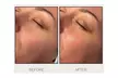 Enjoy Custom or Vox++ Hydrafacial w/ Lymphatic Face & Neck Massage Options at Vox Skin by Olivia (Up To 37% Off) - Second Medium