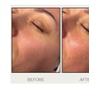 Image 2: Custom or Vox++ Hydrafacial w/ Lymphatic Face and Neck Massage Options