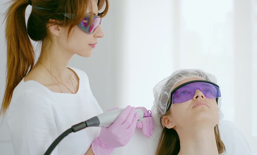 Image 1: Transform Your Skin with 1 or 3 Rosacea Treatment Sessions At Drops of Beauty Anti-Aging Med Spa (Up to 56% Off)