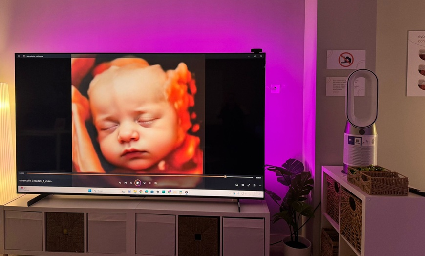Image 4: ¡Conoce a tu bebé! Ecografía emocional 5D o 8K con vídeo y canastilla