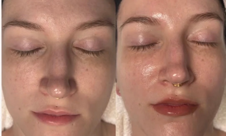Image 4: Age Gracefully. Glow Powerfully. Save Up to 50% on introductory facial