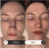 Image 4: Age Gracefully. Glow Powerfully. Save Up to 50% on introductory facial