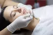 Limpieza facial completa con o sin extracción, ultrasónica con oxígeno, peeling ácido salicílico hasta 60% - Second Medium