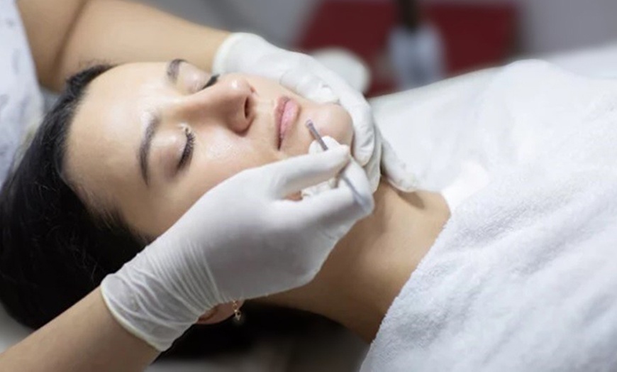 Image 3: Hasta 66% de dto. en Tratamiento facial en Yas to Beauty