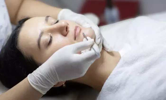 Limpieza facial sin extracción, completa, ultrasónica o peeling