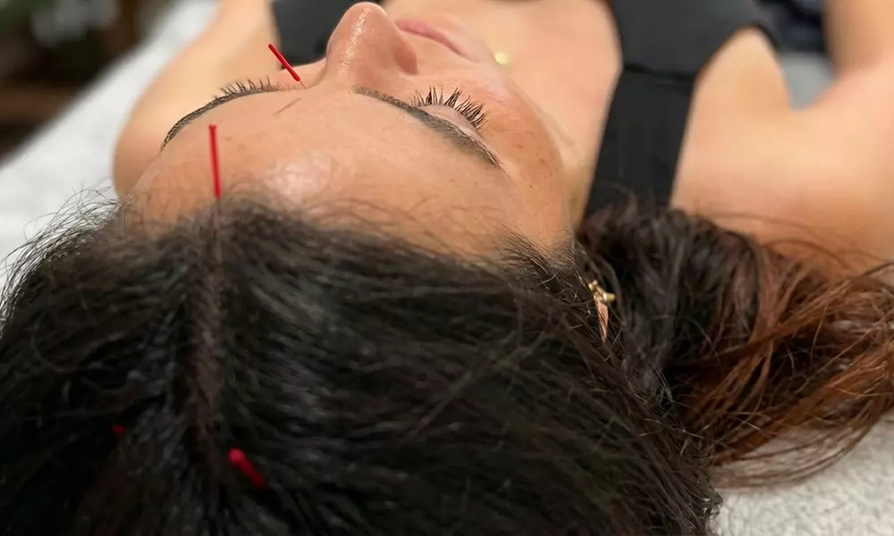 Yoo Balance Therapy & Wellness Offers 1, 3, or 5 Sessions of Acupuncture for Holistic Wellness (Up to 60% Off)