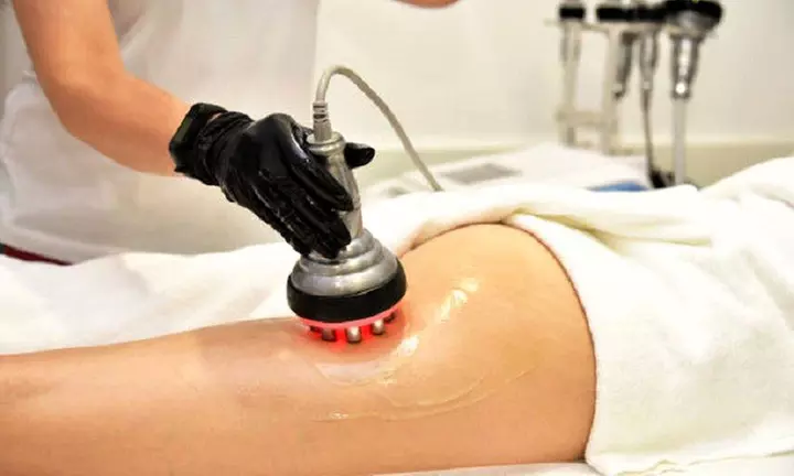 Hasta 72% de dto. en Reducción de grasa/celulitis - Sin marca en Sandra Gutierrez Estetica Avanzada y Bienestar