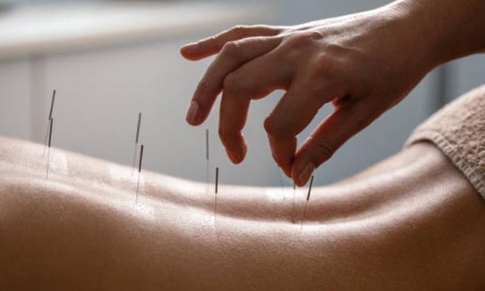 1 o 3 sesiones de acupuntura personalizada con diagnóstico previo