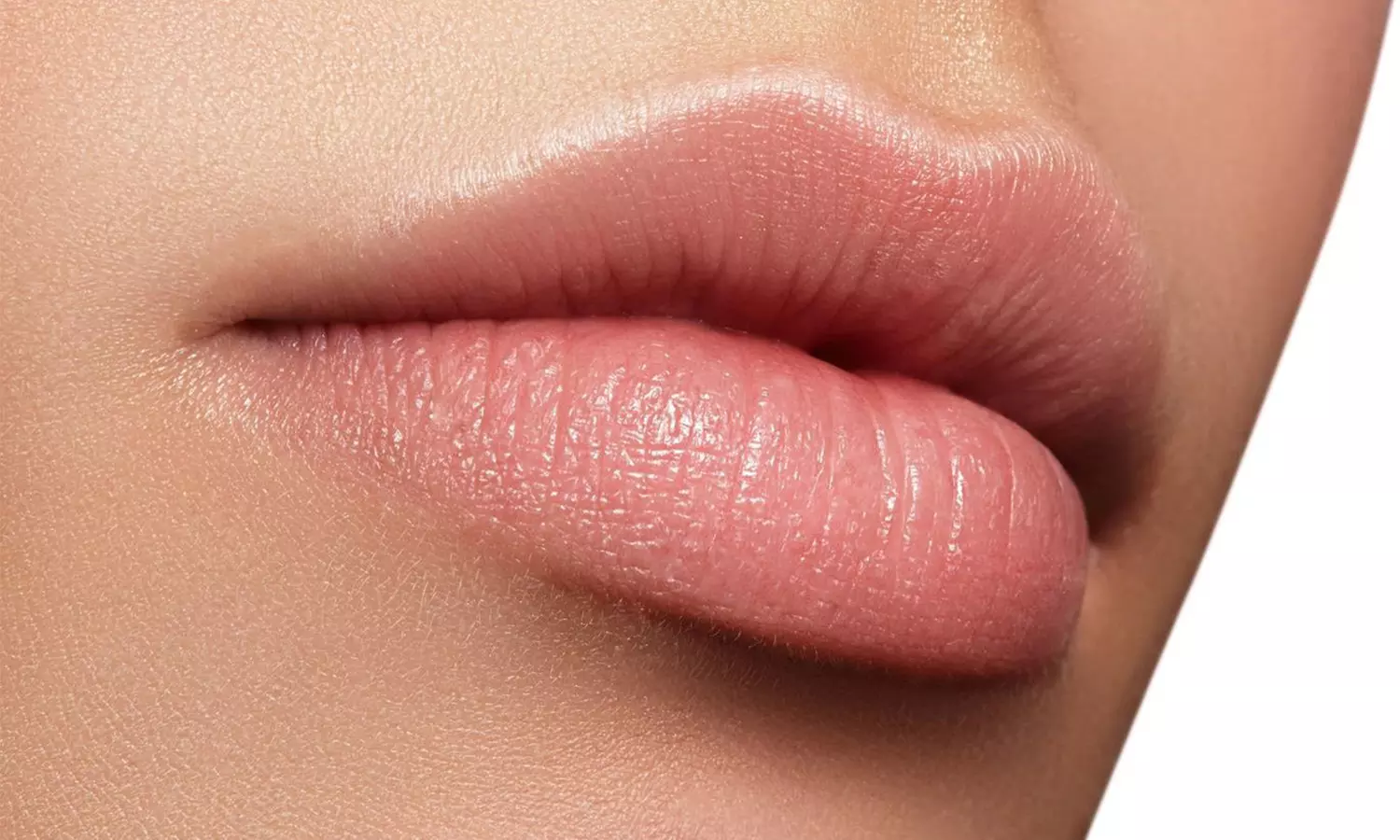$420 for Lip Lightening at AeLeeMD Plastic Surgery and Laser Center ($600 Value) - Primary Image