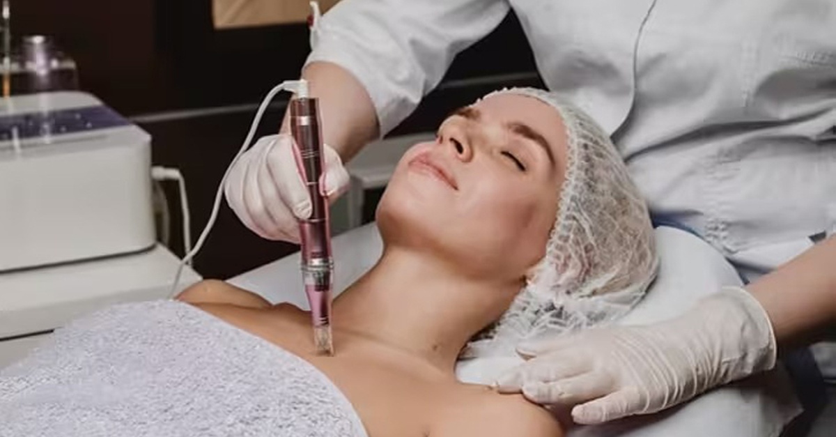 Tratamiento facial con microagujas y terapia LED en Barcelona