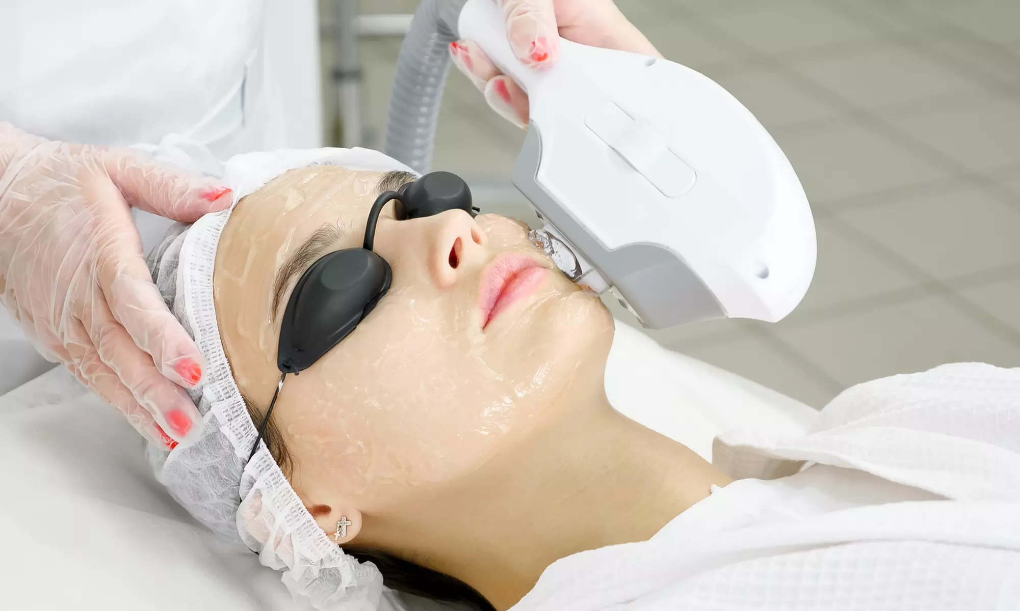 Usuwanie zmian barwnikowych i naczyniowych z wybranych partii