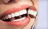 $120 for Teeth Whitening at Edent ($420 Value)