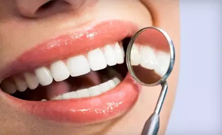 $120 for Teeth Whitening at Edent ($420 Value) - Primary Image