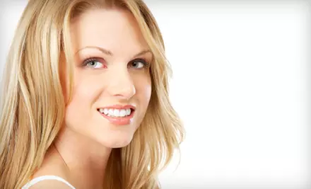 $109 for Custom Take-Home Whitening Trays and Four Tubes of Bleach at Ocean Breeze Dental in Rockledge ($475 Value) - Primary Image