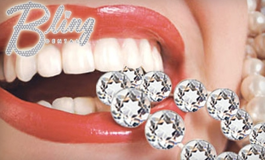 Bling dental teeth whitening reviews