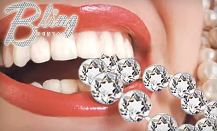 $68 for an Icing Teeth Whitening from Bling Dental ($199 Value) - Primary Image