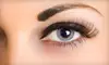 $1,499 for Upper-Eyelid Surgery at New Look New Life Surgical Arts ($4,500 Value) 