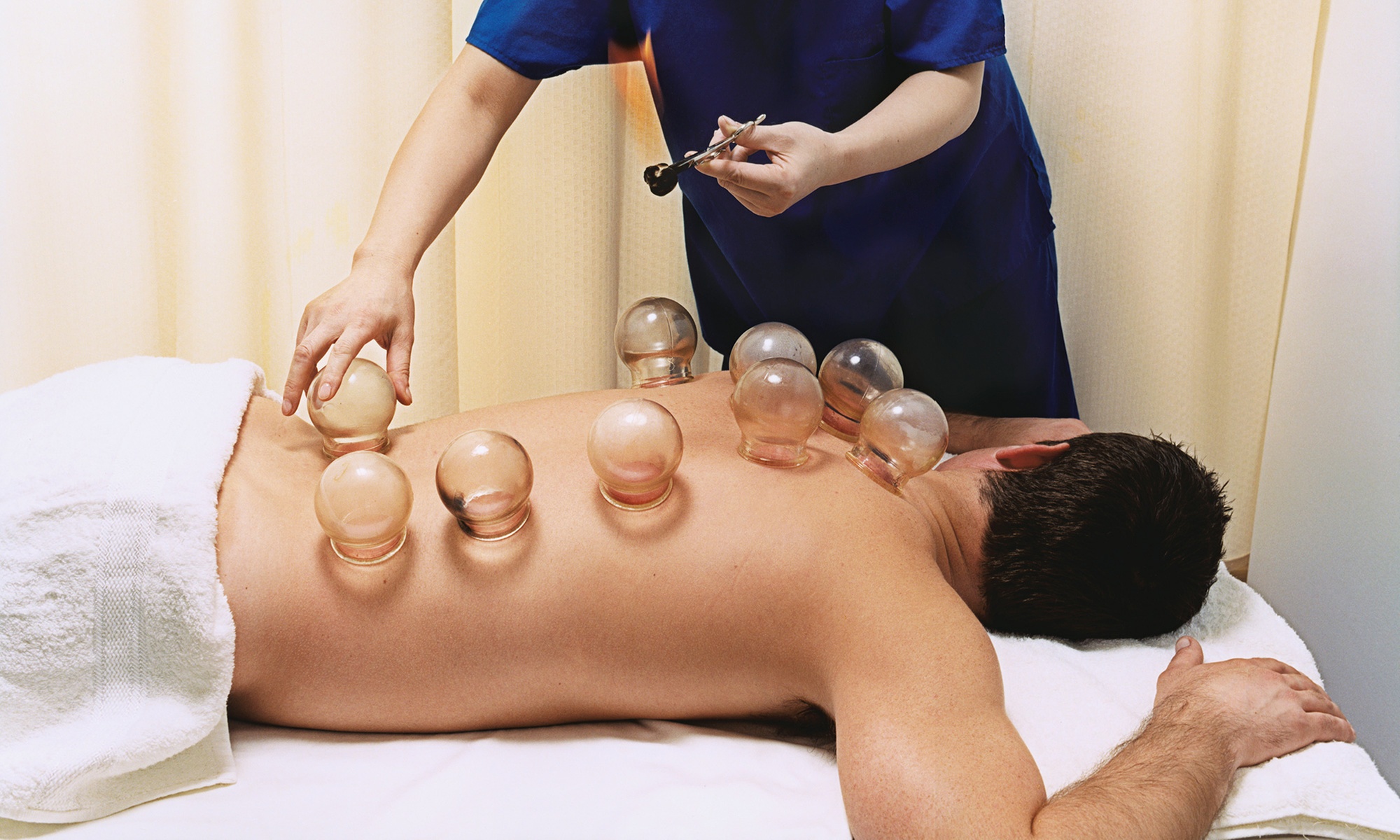 1 or 3 30-Min Back Cupping Massage or 60-Min Full Body Acupuncture