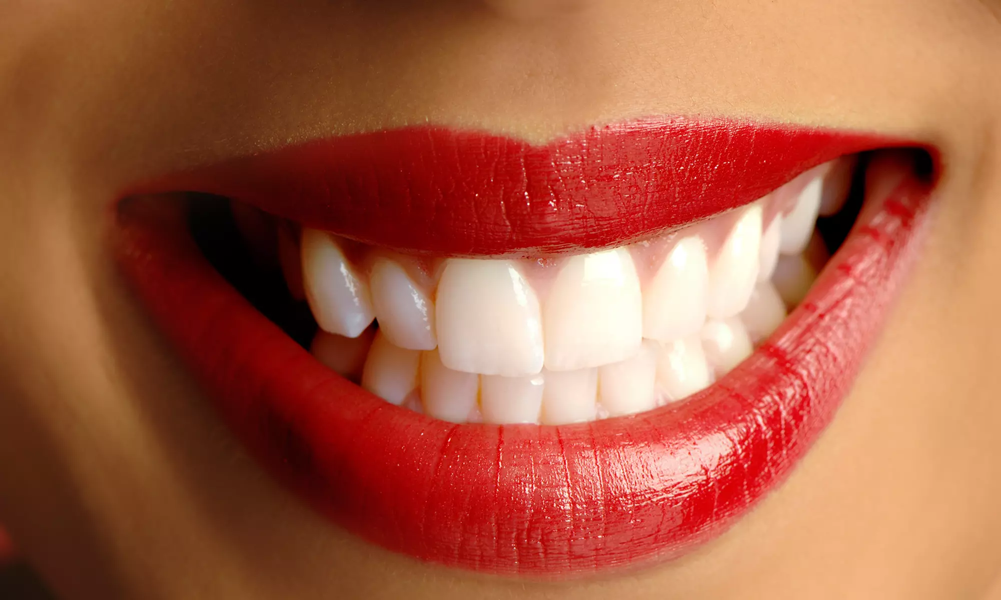 Teeth-Whitening Treatments at Do Beaming White (Up to 65% Off). Three Options Available. - Primary Image
