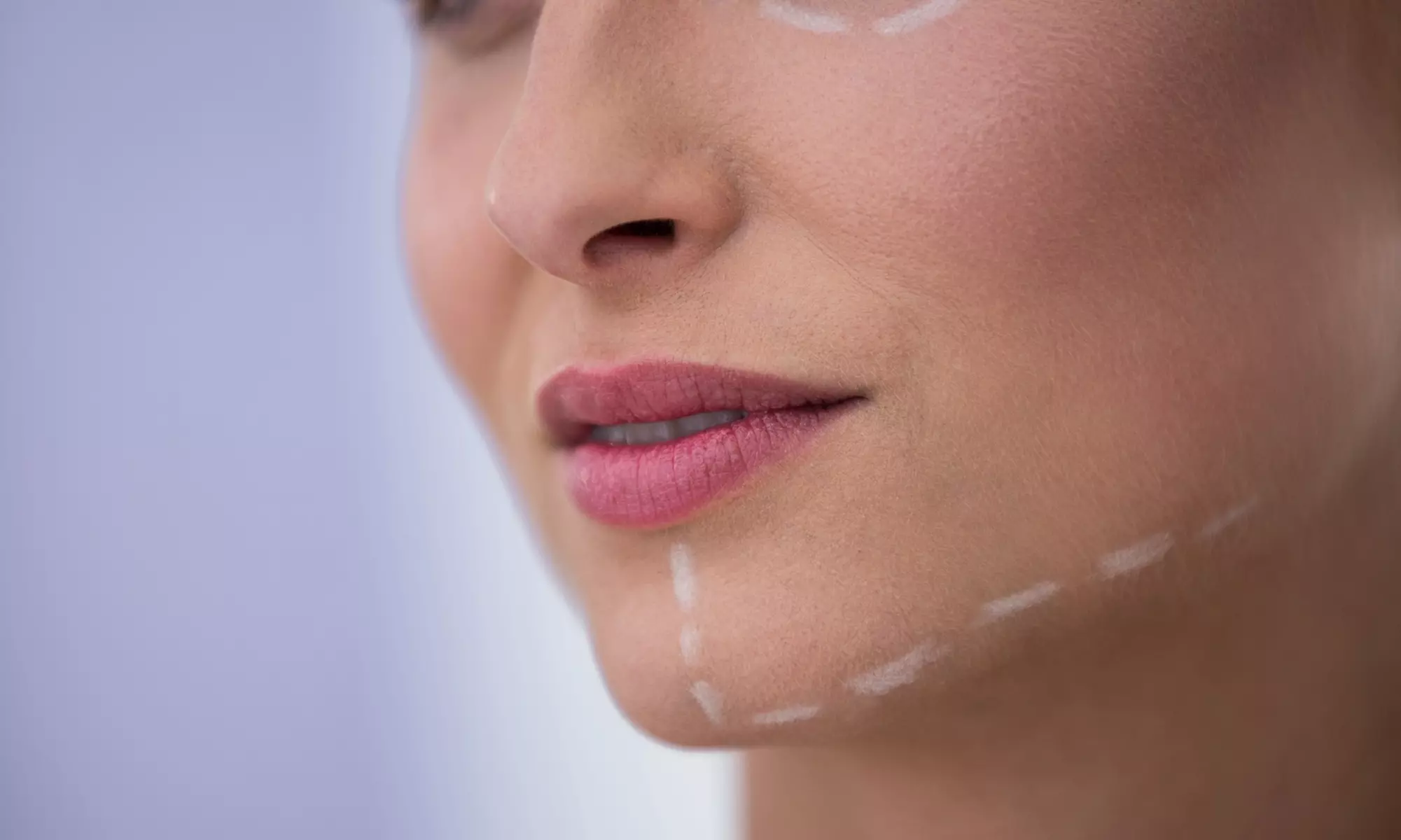 Wertgutschein über bis zu 189€ für eine Injektionslipolyse mit bis zu 15 ml Wirkstoff in der SB clinic - Primary Image