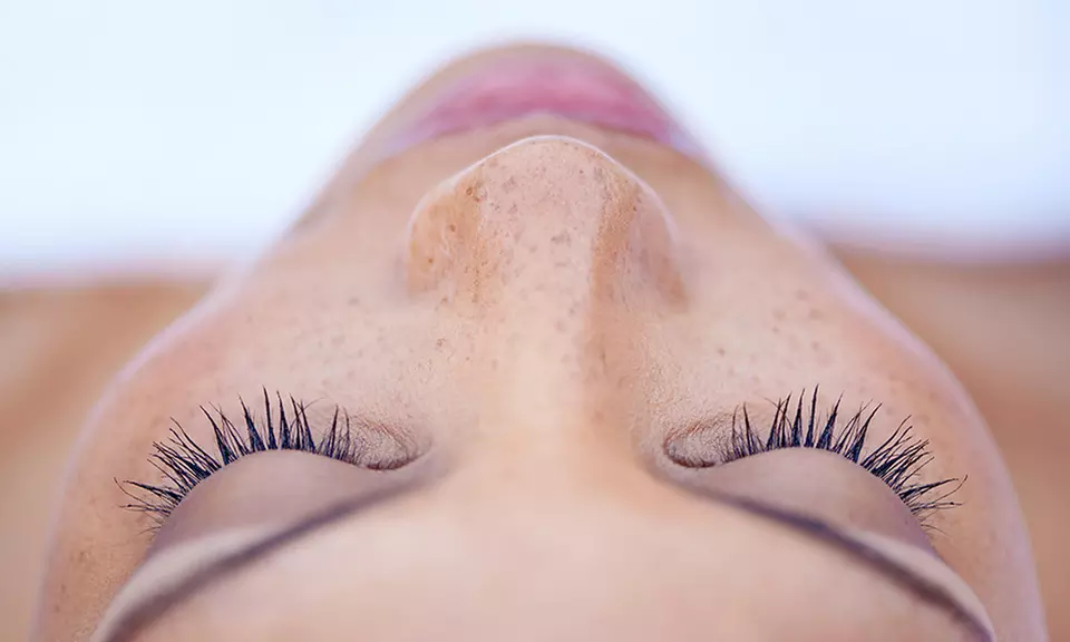 Removal of Up to 3, 6, 10, or 15 Skin Tags at The Skin Center of the Triangle (Up to 66% Off) - Primary Image
