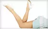$99 for Two Noninvasive Spider-Vein-Removal Treatments Plus Consultation at Tender Laser Care ($700 Value)