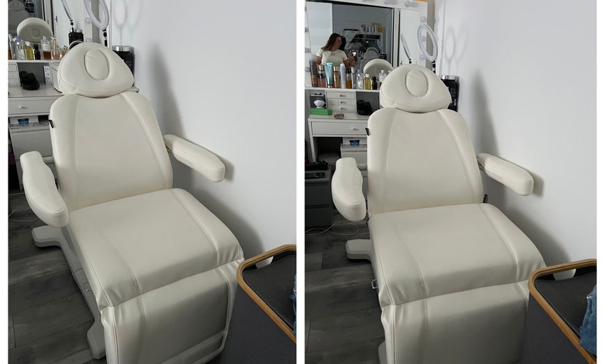 Image 4: Enhance Your Smile with 0.5ml, 1ml & Russian Lips Filler Options