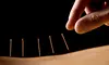 Nutrition-Assessment Packages with Acupuncture at Duvé Wellness Center (Up to 50% Off). Three Options Available.