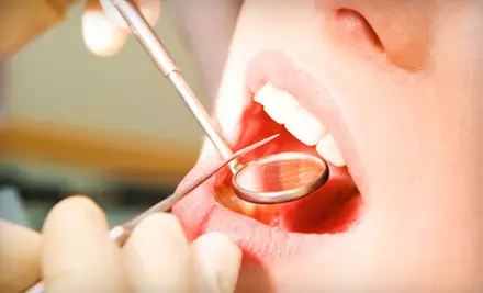 Exam, X-rays, and Cleaning or Take-Home Whitening Kit at James D. Kim DDS Family Dentistry in Salinas - Primary Image