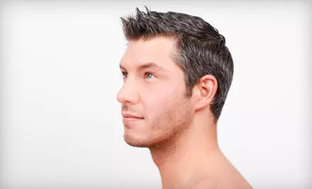 Four, Six, or Eight Weeks of Laser Hair-Regrowth Treatments at Sunrise Hair Design (Up to 54% Off)  - Primary Image