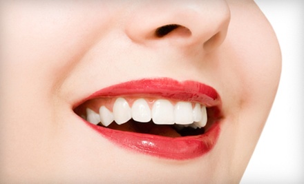 $95 for SpaWhite Teeth Whitening and Exam at Dr. Leialoha Leung, D.D.S., Inc. ($272 Value) - Primary Image