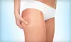 Skin-Tightening Treatments at Canadian Beauty College in Mississauga. Four Options Available. 