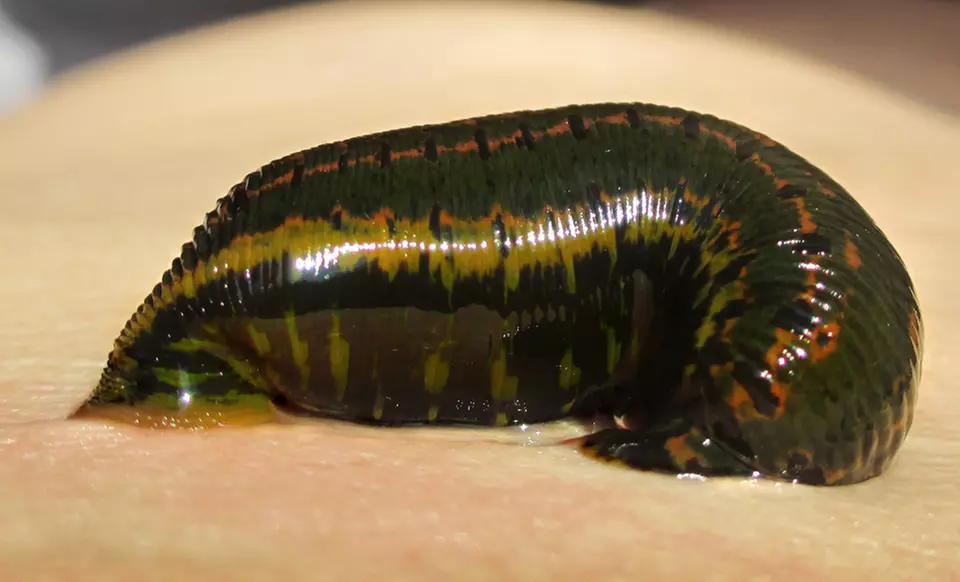 One or Two Leech Therapy Sessions with Initial Consultation at Chicago Hirudotherapy (Up to 55% Off) - Primary Image