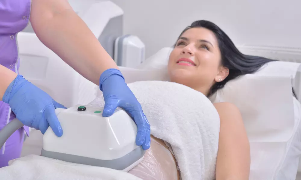 Cryolipolysis Fat Freezing at Miami Kiss