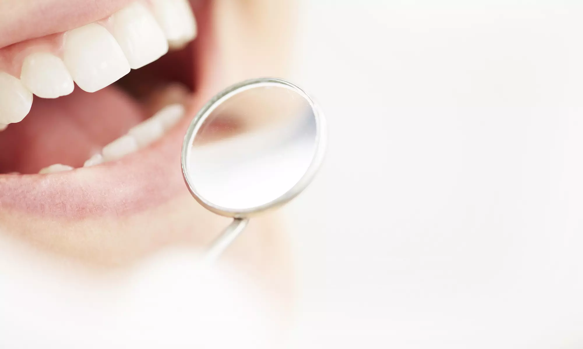 Up to 73% Off Cleaning or Whitening at Healthy Smiles - Primary Image