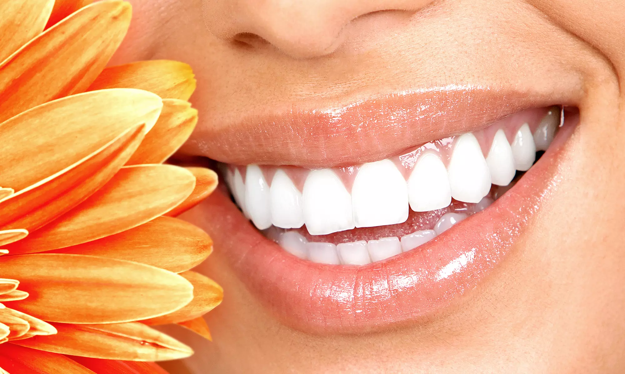 One, Two or Three Teeth-Whitening Sessions at Sports Cutters (78% Off) - Primary Image