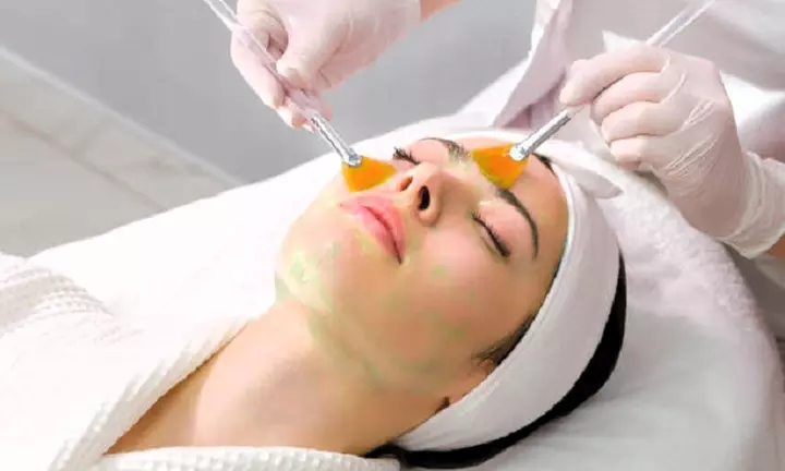 Peeling facial en Sandra Gutiérrez Estética Avanzada y Bienestar