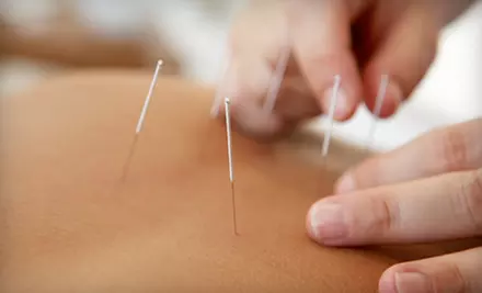 Acupuncture and Massage or Sugar-Scrub Package at Serenity Spa and Natural Health Clinic in Tacoma - Primary Image